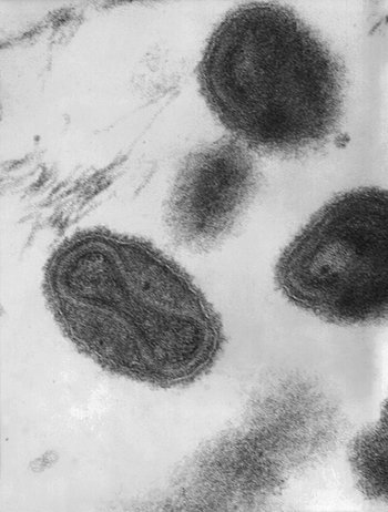 Kopper har sin årsag i et 0,0003 millimeter stort virus, som her er afbildet på et elektronmikroskopisk billede